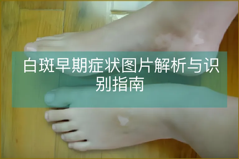 白斑早期症状图片解析与识别指南