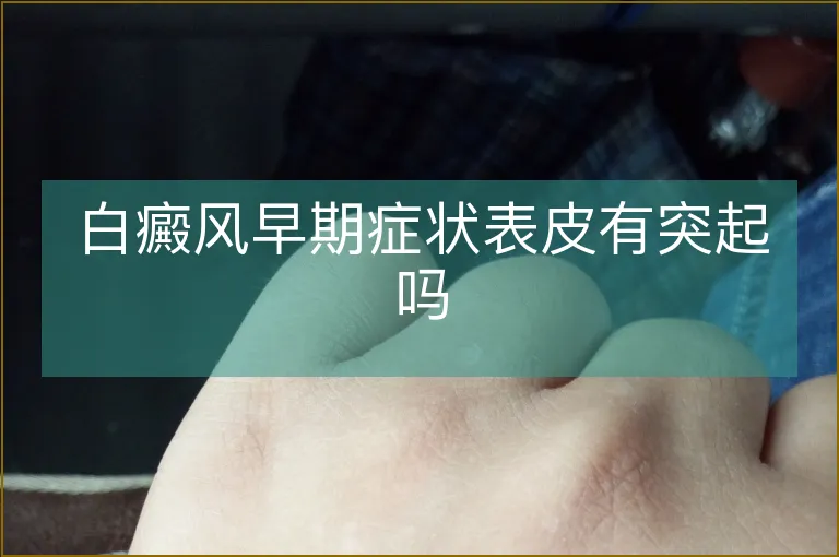 白癜风早期症状表皮有突起吗