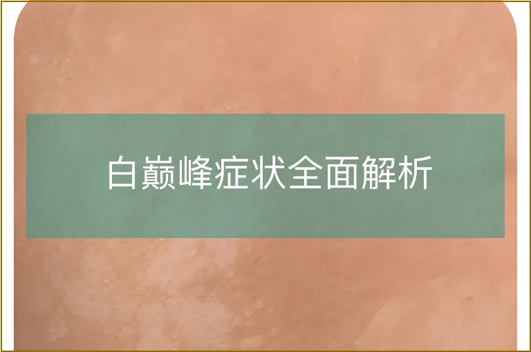 白巅峰症状全面解析
