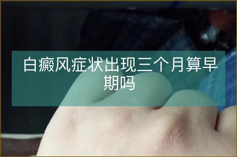 白癜风症状出现三个月算早期吗