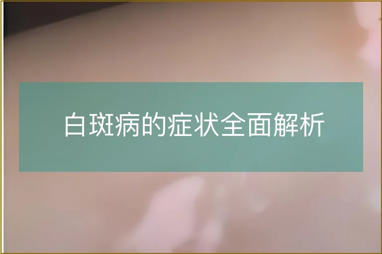 白斑病的症状全面解析