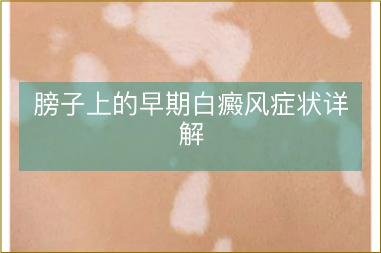 膀子上的早期白癜风症状详解