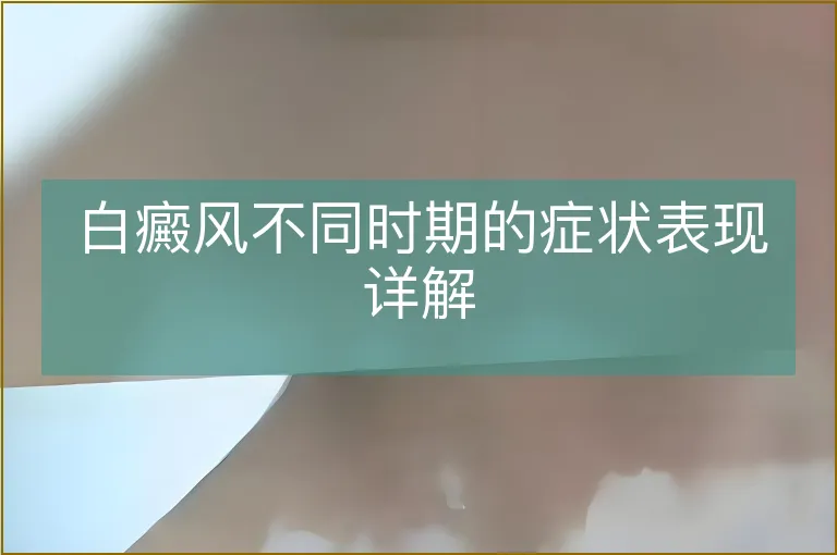 白癜风不同时期的症状表现详解