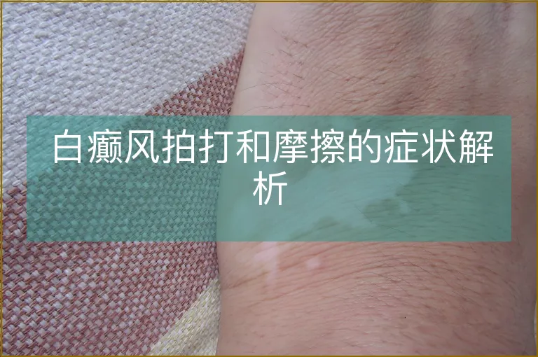 白癫风拍打和摩擦的症状解析
