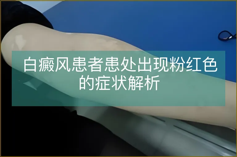 白癜风患者患处出现粉红色的症状解析