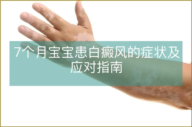 7个月宝宝患白癜风的症状及应对指南