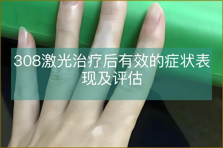308激光治疗后有效的症状表现及评估