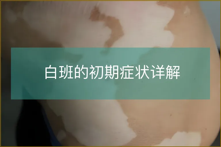 白班的初期症状详解