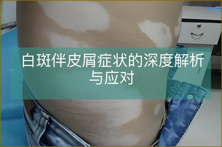 白斑伴皮屑症状的深度解析与应对