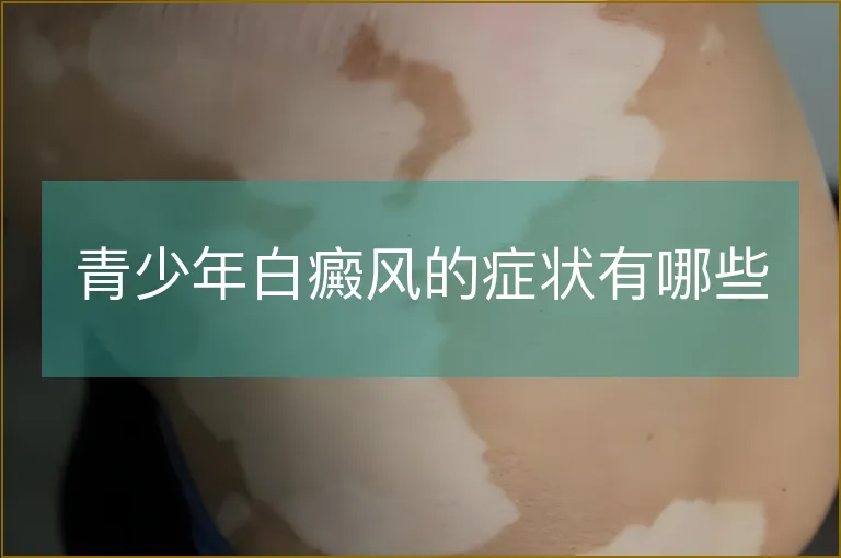 青少年白癜风的症状有哪些