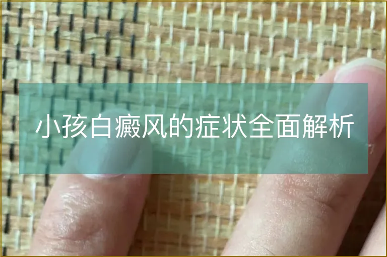 小孩白癜风的症状全面解析