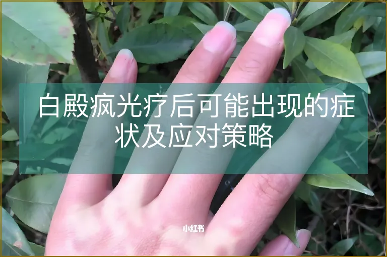 白殿疯光疗后可能出现的症状及应对策略