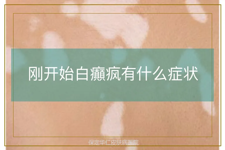 刚开始白癲疯有什么症状