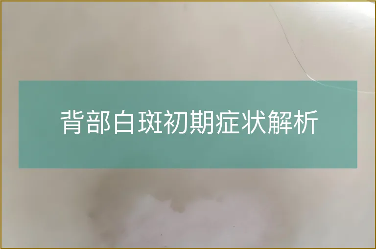 背部白斑初期症状解析