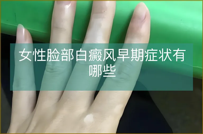 女性脸部白癜风早期症状有哪些